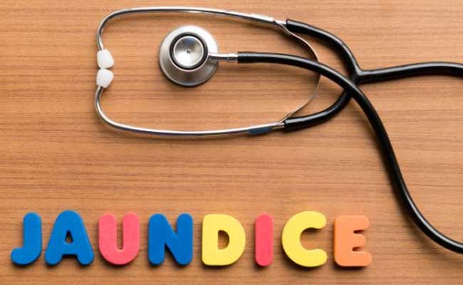Jaundice- Causes and Symptoms