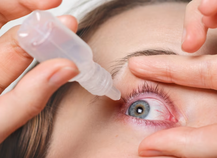 Glaucoma Causes, Symptoms, and Treatment